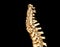 CT SCAN of Cervical Spine ( C-spine )  3D rendering image