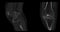 CT Scan of Knee joint for medical background