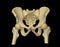 CT scan of Pelvic bone and hip joint 3D rendering for diagnosis fracture of Pelvic bone and hip joint isolated on black background