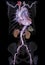 CTA abdominal aorta 3D rendering image  on transparent skeletal