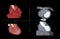 CTA Coronary artery  3D rendering image.