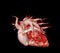 CTA pulmonary arteries 3D