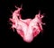 CTA pulmonary arteries 3D r