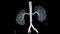 CTA Renal artery 3D is a medical imaging procedure using CT scans to examine the renal arteries It provides detailed images of the