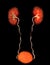 CTA Renal artery  3D rendering image  showing both kidney, Ureter and bladder