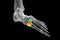 Cuneiform bones of the foot, 3D illustration