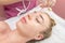 Cupping facial massage, close-up