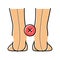 curvature of legs inward color icon vector illustration