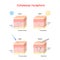 Cutaneous receptors. layers of the human skin with sensory receptors