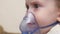 A cute baby in a mask is breathing through an inhaler. Home inhalation procedure. The child is receiving respiratory