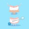 Cute cartoon denture