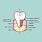 Cute cartoon tooth implant anatomy