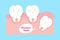 Cute cartoon wisdom teeth