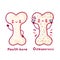 Cute happy funny healthy and osteoporosis bone