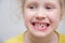 cute smiling girl demonstrates fallen milk tooth