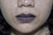 Cyanotic lips or central cyanosis at Southeast Asian young woman