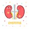 Cystitis kidneys poster