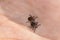 A dangerous tick on human skin