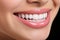 Dazzling White Teeth. Close-Up of the Perfect Smile to Captivate and Inspire in Marketing Campaigns