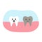 Dead decay tooth character in cartoon flat style. Vector illustration of disgruntled unhealthy teeth, dental health