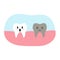 Dead decay tooth character in cartoon flat style. Vector illustration of disgruntled unhealthy teeth, dental health concept, oral