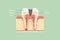 Decay tooth anatomy structure including the bone and gum with detail word