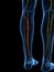 The Deep Peroneal Nerve