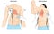 Defibrillator cardioversion