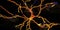 Degeneration of dopaminergic neuron, a key stage of development of Parkinson`s disease