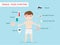 Dengue fever symptoms infographics