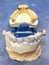 Dental articulator with gypsum cast on working table