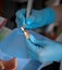 dental assistant cleaning dentures