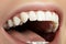 Dental Beauty. Beautiful Macro with perfect White Teeth. Fashion Lips Natural Make-up. Whitening Tooth, Wellness