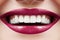 Dental Beauty. Beautiful Macro with perfect White Teeth. Fashion Lips Red Make-up. Whitening Tooth, Wellness Treatment