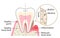 dental biofilm and healthy tooth. dental hygiene and health care concept