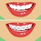 Dental braces, before and after