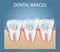 Dental braces vector medical poster design template