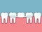 Dental bridge and row of teeth