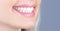 Dental care. Dentistry concept. Perfect healthy teeth. Closeup shot of woman& x27;s toothy smile. Perfect healthy teeth smile