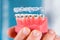Dental care.Smiling orthodontist doctor holding aligners and braces in hand shows the difference between them