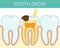 Dental caries