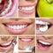 Dental collage