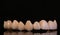 Dental crowns. Close-up ceramic tooth crown