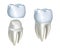 Dental crowns and tooth