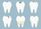 Dental diseases. Tooth decay, inflammation, dental plaque, periodontal disease. Concept of dentistry and medicine