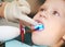 Dental filing of child tooth by