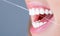 Dental flush - woman flossing teeths. Dental floss. Taking care of teeth. Healthy teeth concept. Teeth Flossing. Oral