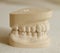 Dental gypsum model mould of teeth