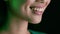 Dental Health. Closeup Shot Of Young Woman Smiling With Beautiful White Teeth