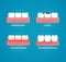 Dental health illustration